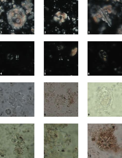 Photomicrographs Of Selected Calcareous Nannofossils Identified In The