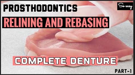 Relining And Rebasing In Complete Denture Ii Introduction And Direct