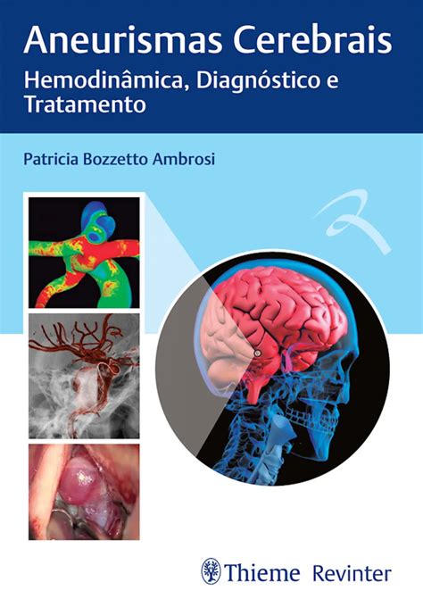 Aneurismas Cerebrais Hemodinâmica Diagnóstico E Tratamento Loja Skeelo