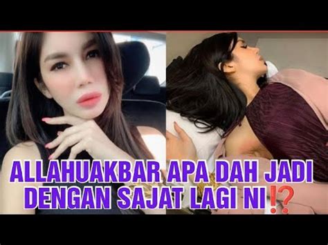 Setelah Mendedahkan Penyakitnya Tak Sangka Ini Yang Berlaku Kepada