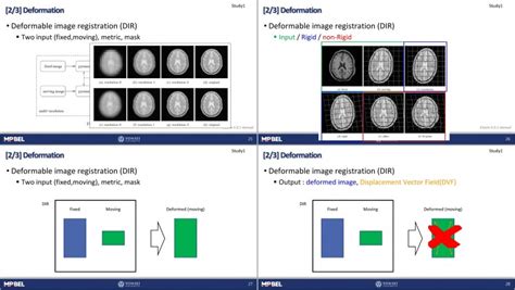 Research Seminar Dosimetricimpactof Prostatedeformationdue To