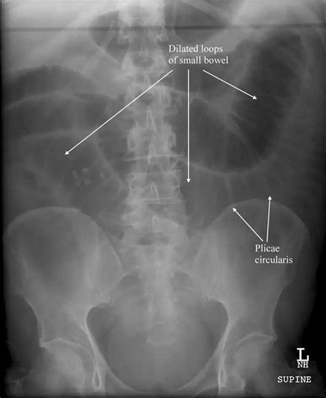 Pin on School | Radiography, Movie posters, X ray