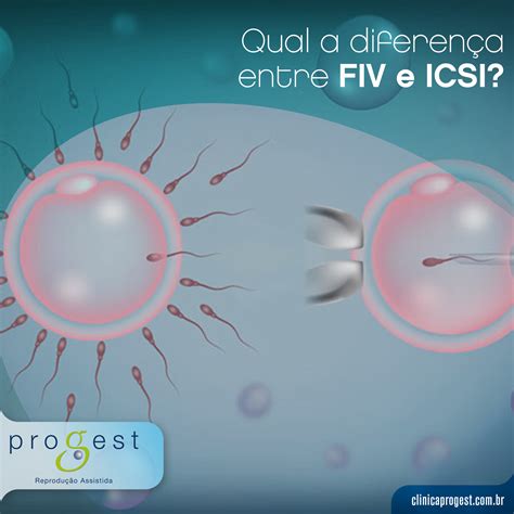 Qual Da Diferen A Entre Fiv E Icsi Cl Nica Progest Reprodu O Assistida