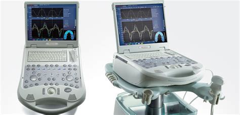 Esaote Mylab 30 Gold Ultrasound