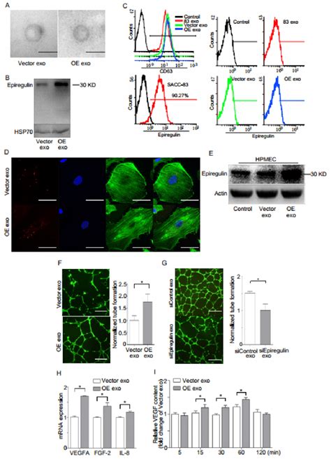 Epiregulin Enriched Exosomes Derived From Sacc Cells Stably