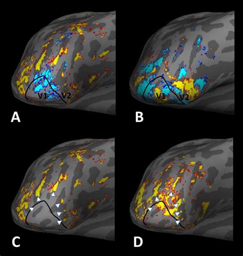 High Resolution FMRI Activity Evoked By Scotopic Stimuli Relative To