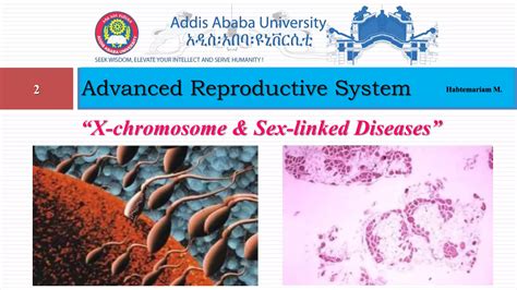 X Chromosome And Sex Linked Diseases Pptx