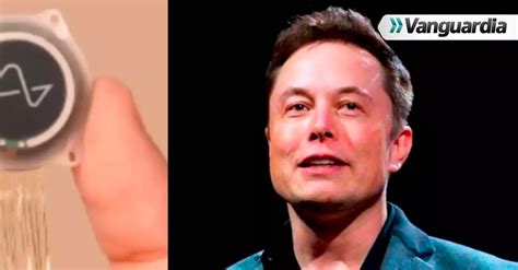 Neuralink de Elon Musk iniciará pruebas en humanos para implantarles