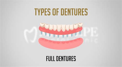 Different Types Of Dentures: Which One Is Right For You? - Maltepe ...