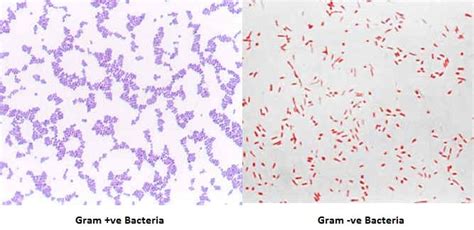 Gram Staining- Principle, Reagents, Procedure, Steps, Results