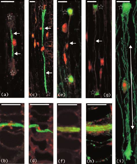 Indirect Immuno ̄uorescence Localisations Of Cytoskeletal Proteins And