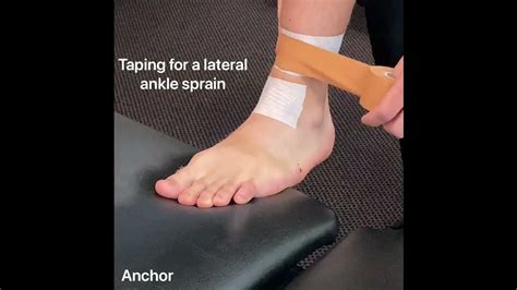 Ankle Taping For Lateral Ankle Sprain Youtube