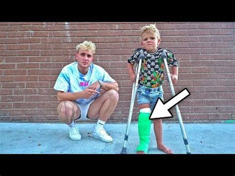 Tydus BROKE HIS LEG!! (hospital) | Jake paul youtube, Jake paul, Bikini ...