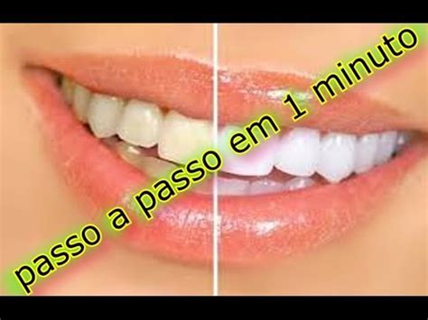 Como Clarear Os Dentes Bicarbonato Em Casa Receita Caseira Sem