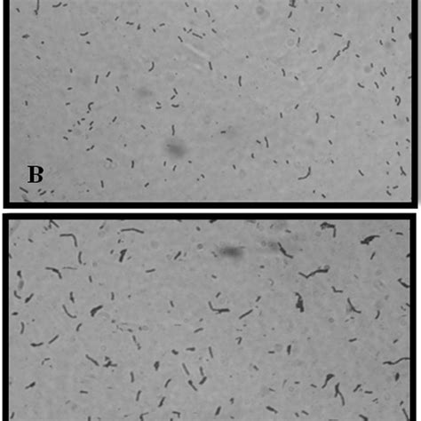 Optical Microscopic Image 100x Of Escherichia Coli A And Bacillus Download Scientific