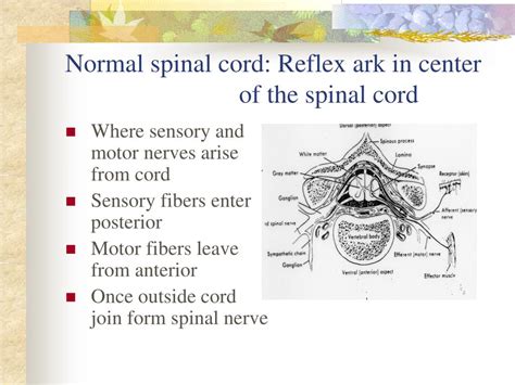 PPT - Traumatic Spinal Cord Injury PowerPoint Presentation, free ...