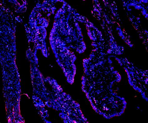 Chromogranin A Detection Of Neuroendocrine Markers Omicsveu