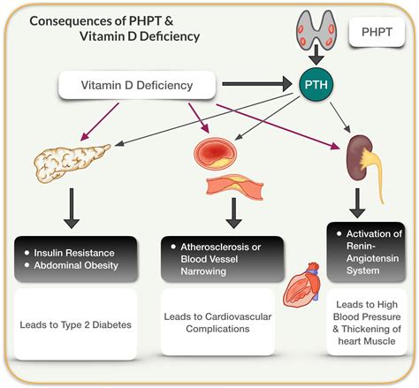 Vitamin D_image 4 - Hyperparathyroidism Surgery - Dr. Babak Larian