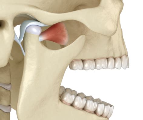 Tratamiento ATM de articulación temporomandibular Clínica Marta Vallés