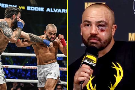 Conor McGregor's UFC rival Eddie Alvarez shows off gruesome eye injury ...