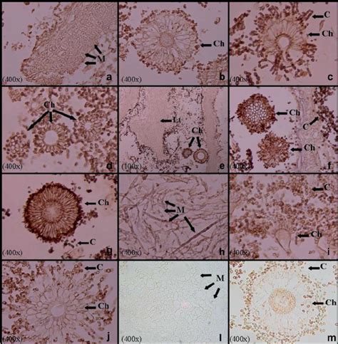 Wheat Germ Agglutinin Wga Lectin Staining In Aspergillus Spp In