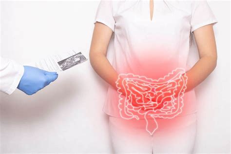 Cuidado Con La Diverticulitis Te Explicamos Qué Es Y Cómo Evitarla