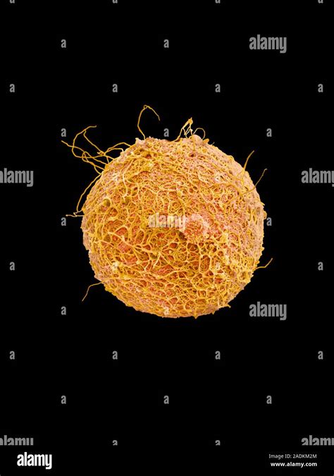 Fertilisation Coloured Scanning Electron Micro Graph SEM Of Sperm