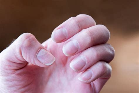 16 Disturbing Things Your Nails Reveal About Your Health Facty Health