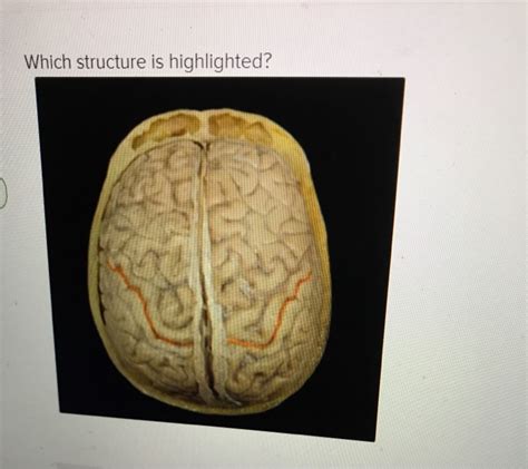 Solved Which Structure Is Highlighted Multiple Choice O Chegg