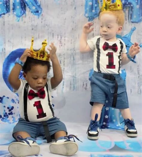 Mom Gives Birth To Black And White Twins But Both Parents Are Black - Go Viral!