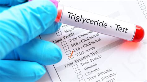 Risk Factors Of High Triglycerides And 7 Ways To Control It Healthshots