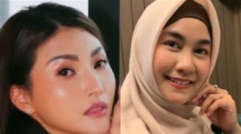 Beda Nasib Eks Personel Cherrybelle Sarwendah Tan Dengan Anisa Rahma