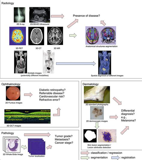 Sample Applications Of Machine Learning For Medical Imaging Radiology