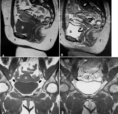 Female Pelvic Anatomy Ct Human Anatomy