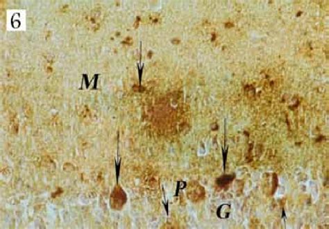 A Photomicrograph Of A Section In The Cerebellar Cortex Of An Download Scientific Diagram