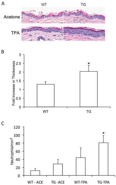 Slug Modulates TPA Induced Epidermal Hyperplasia And Acute Cutaneous