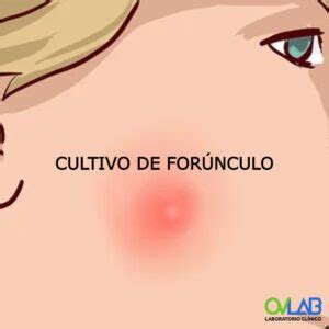 CULTIVO SECRECIÓN VAGINAL OVLAB O V Laboratorios