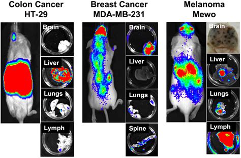 Bioluminescent Imaging And Organ Specific Metastasis Of Human Cancer Cells