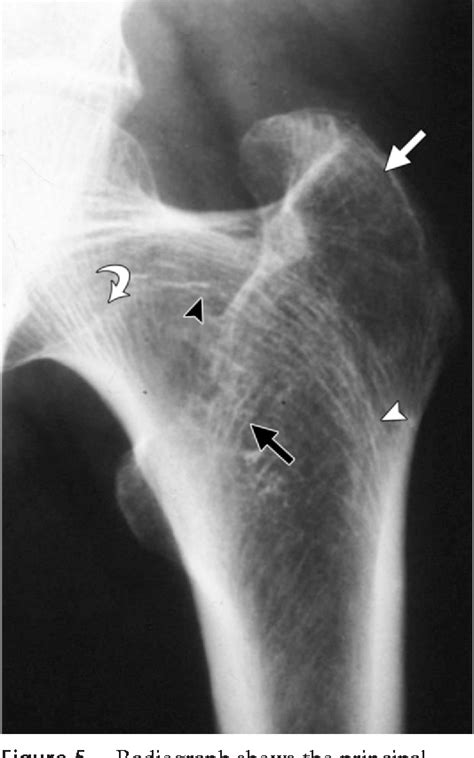 Figure 1 From Integrated Imaging Approach To Osteoporosis State Of The