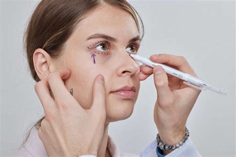 Blépharoplastie Que devez vous savoir