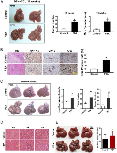 4‐pba Promoted Chemical Carcinogen‐induced And Driver Gene‐induced Hcc Download Scientific