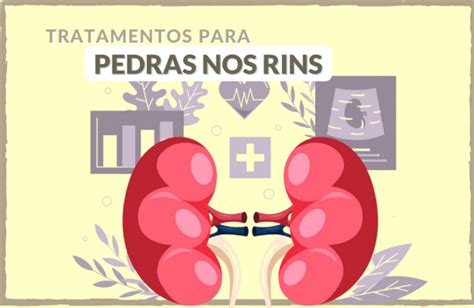 Cálculo Renal Quais os tratamentos mais indicados Instituto Ellos