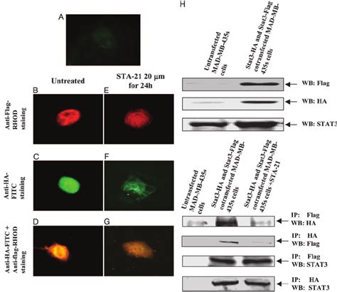 STA 21 Inhibits Stat3 Translocation And Dimerization In Breast