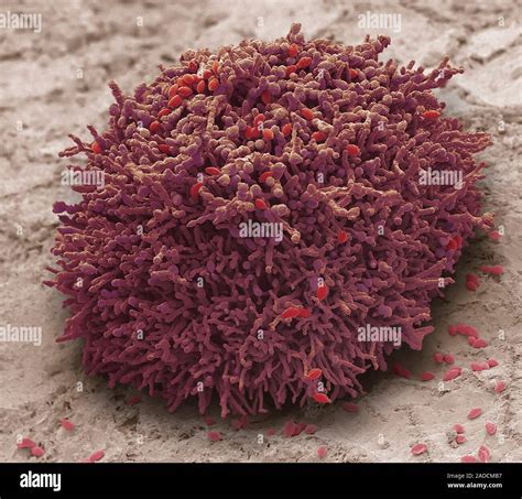 Mould Colony Coloured Scanning Electron Micrograph Sem Of Fungi From