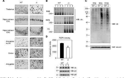 Figure From Essential Role Of Sequestosome P In Regulating