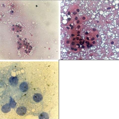 A And B Smears Showing Many Clusters Of Round Cells With A Low Download Scientific Diagram