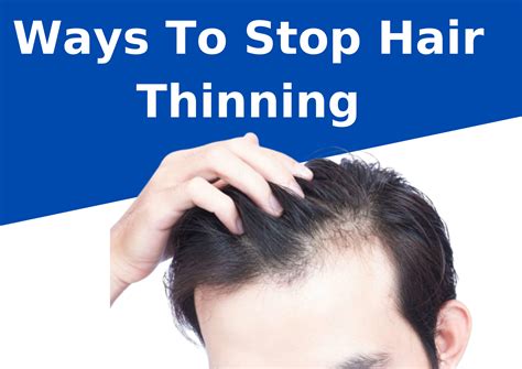 How To Stop Female Crown Hair Thinning Atelier Yuwaciaojp