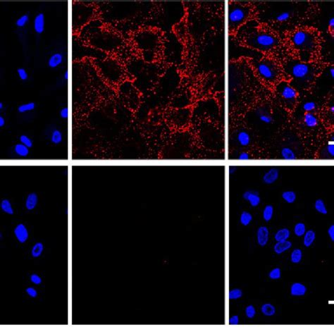 Phenotype Identification Of The Cultured Human Rpe Cells Using