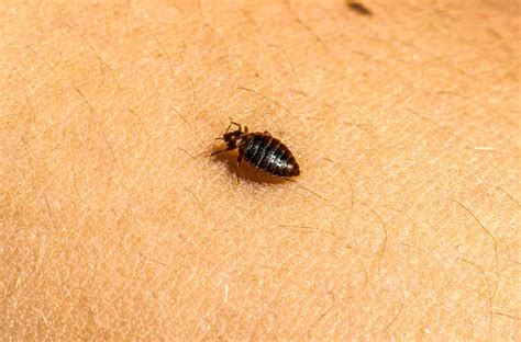 Bed Bug Bites On Black Babies