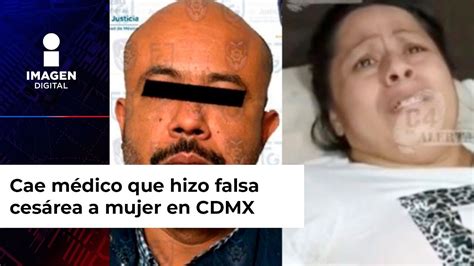 Caso mellizos Cae médico que hizo falsa cesárea a mujer en CDMX YouTube